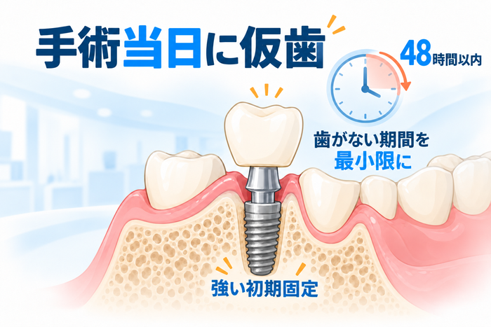 即時荷重インプラントとは？手術当日に仮歯を装着する治療法