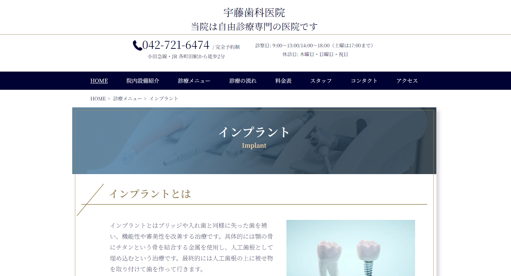 宇藤歯科医院公式HPキャプチャ