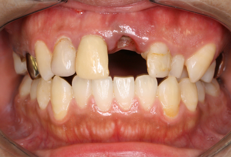 治療前（Before）