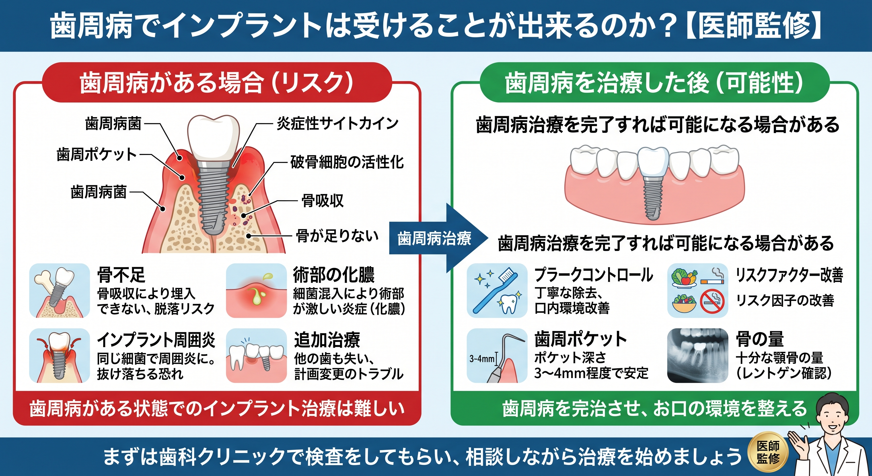 歯周病でインプラントは受けることが出来るのか？