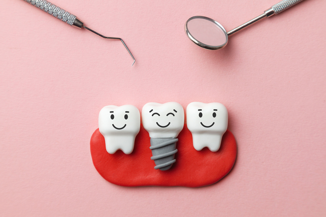 即時荷重インプラント